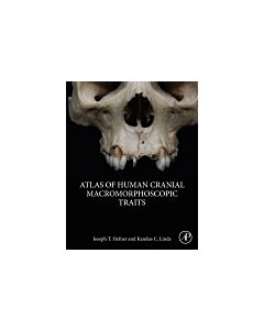 Atlas of Human Cranial Macromorphoscopic Traits (Instant Digital Access Code Only) 9780128143858